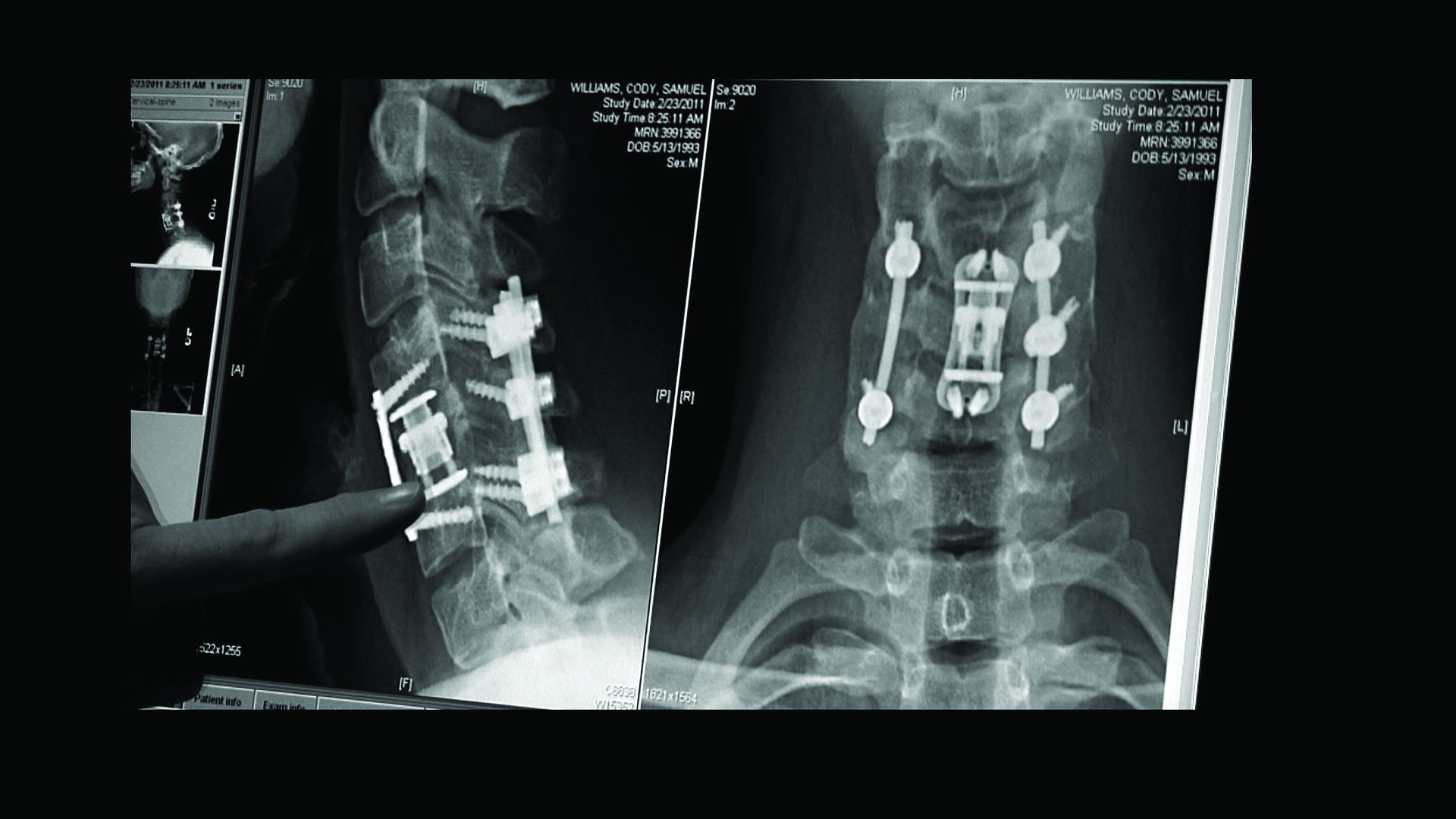 The Hill Chris Climbed: The Gridiron Heroes Story